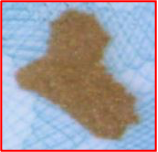 Anchor feature 1 detail